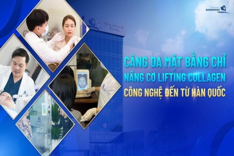 Căng Da Mặt Bằng Chỉ Nâng Cơ Lifting Collagen – Công Nghệ Đến Từ Hàn Quốc