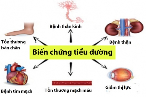 Phát hiện nhân tố có thể giúp tăng hiệu quả điều trị bệnh đái tháo đường