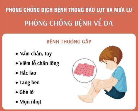 Phòng chống bệnh ngoài da trong mùa bão lũ